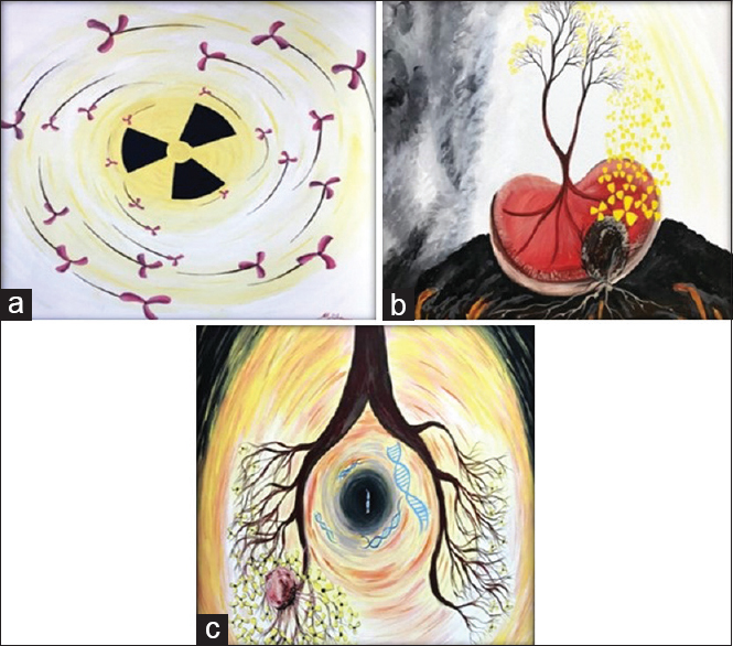 Patient paintings depicting the processes of radiotherapy and chemoradiotherapy. (a) An 82-year-old female patient suffering from a painful and degenerative meningioma depicts the therapy room and the device delivering radiotherapy. “I feel, therefore I am” (Andre Gide). (b) A 42-year-old patient with a diagnosis of primary renal cell carcinoma depicts the dream of recovery following radiotherapy due to relapse after all primary treatment. “The difficult is what takes a little time; the impossible is what takes a little longer” (Fridtjof Nansen). (c) A 55-year-old small cell lung cancer patient in concomitant chemoradiotherapy paints the dreamed healing process. “If you can dream it, you can do it” (Walt Disney)