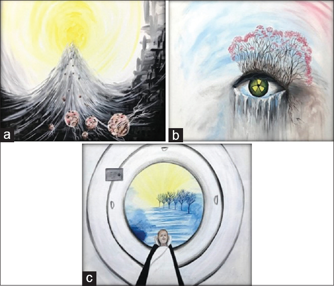 Emotions of patients with extensive metastasis following palliative treatment. (a) A 57-year-old male patient with malignant melanoma metastasizing to the bone, brain, and lungs depicts feelings following immunotherapy, chemotherapy, and radiotherapy. “Hope the following page. Do not close the book” (Edmond Jabès). (b) A 29-year-old breast cancer patient with metastasis to the liver and local relapse depicting feelings prior to palliative radiotherapy for unrelieved pain. “Each beginning has an end” (Shakyamuni Buddha). (c) A 55-year-old patient with metastatic lung cancer depicting feelings of relief after painful metastasis to the bone was stopped by radiotherapy. “Good deeds put a smile of happiness on another's face” (Prophet Muhammad PBUH)