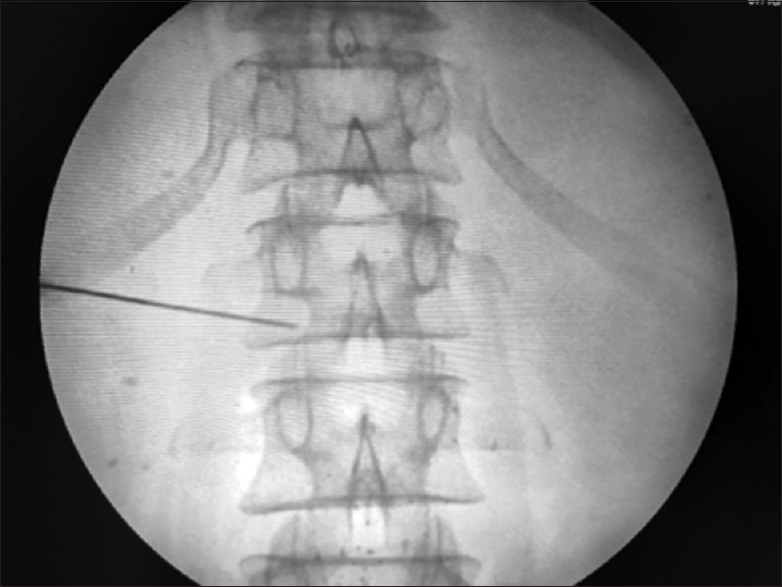 “Antero-posterior view”