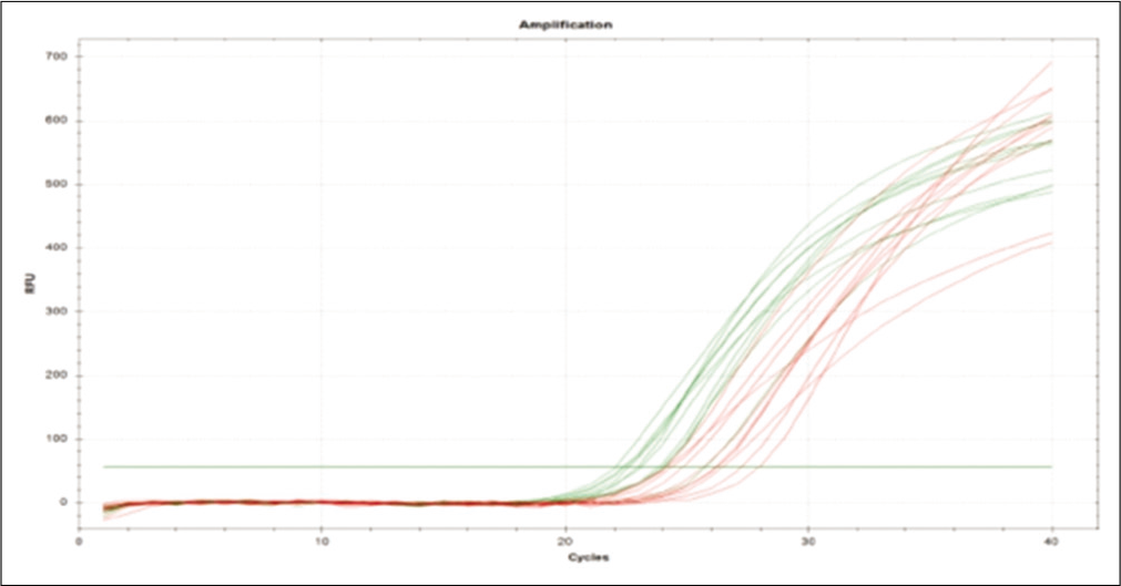 Amplification plot of extracellular signal-regulated protein kinase and tissue inhibitors of matrix metalloproteases 1 gene.